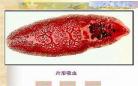 寄生虫与微生物的关系